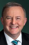 Anthony Albanese