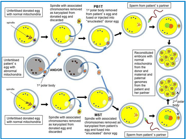 Figure 3.3—First polar body transfer